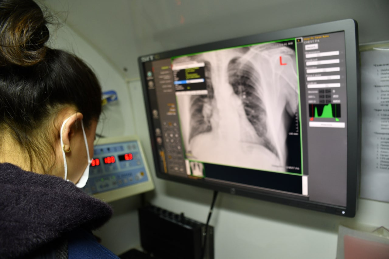 Сүрьеэ өвчнөөс сэргийлье